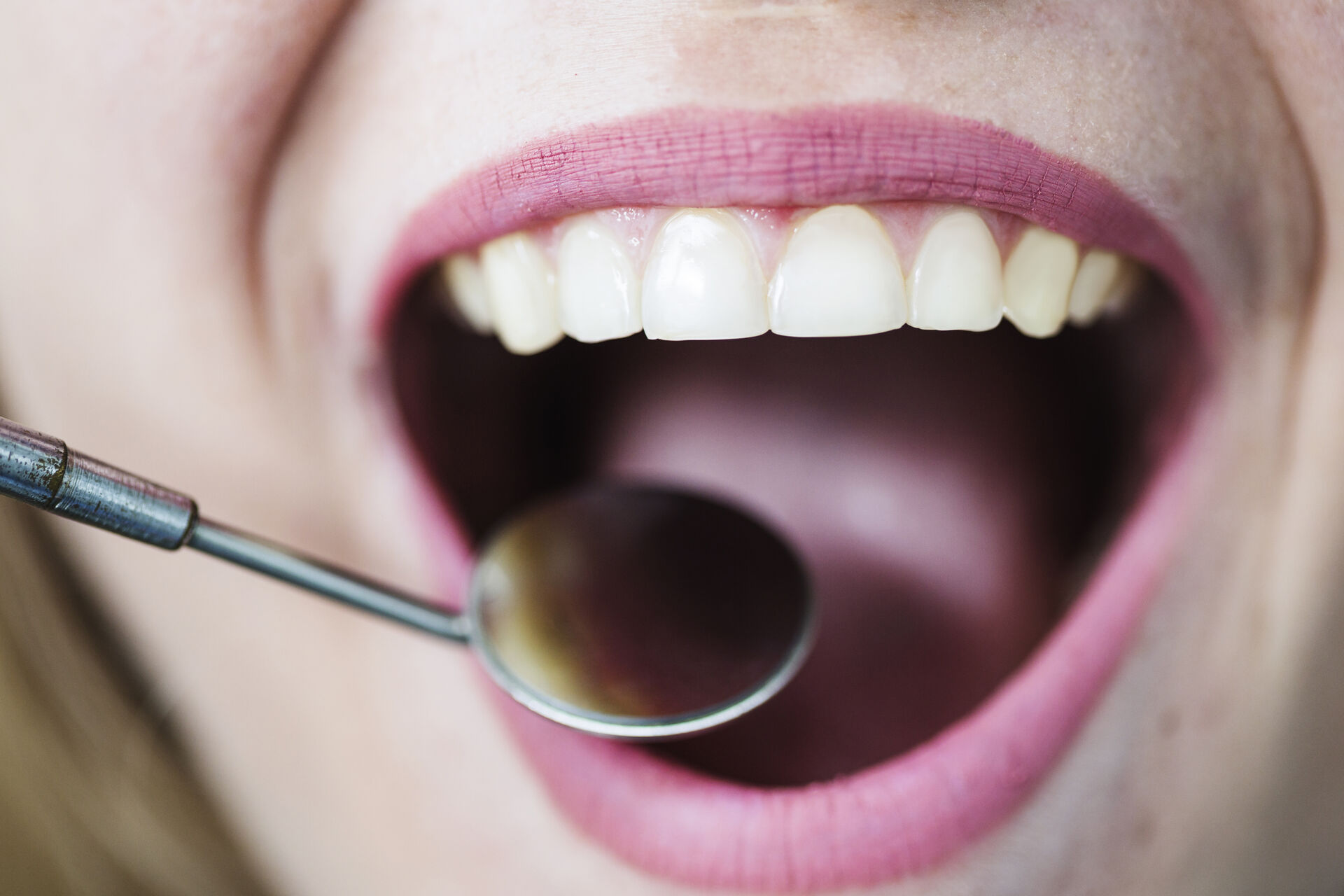 Specializzazione denti del giudizio